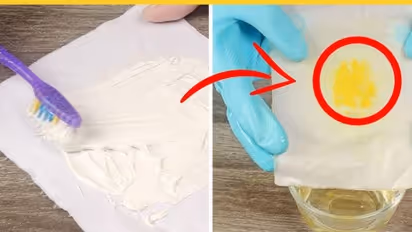 How to remove turmeric stain from white clothes