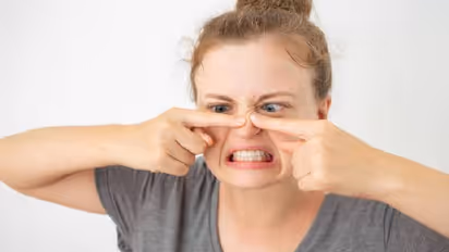 How to get rid of blackheads