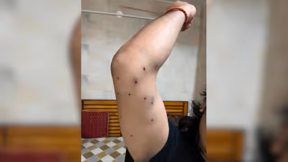 delhi police denies pellet attack during jantar mantar protest