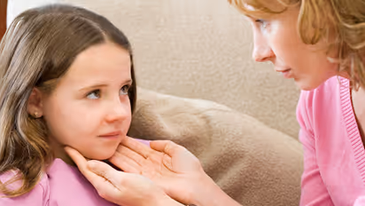 kissing disease symptoms