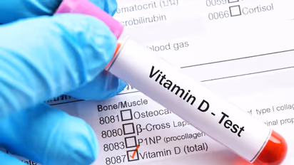 Vitamin D Test