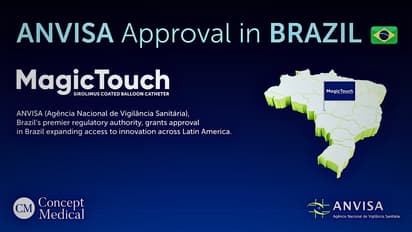 MagicTouch Brazil Approval: 5 Reasons This Breakthrough Redefines Cardiac Care