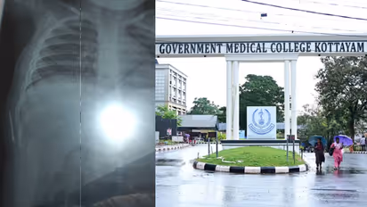Needle found in infant body Kerala