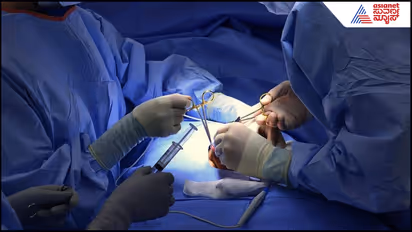 Operation