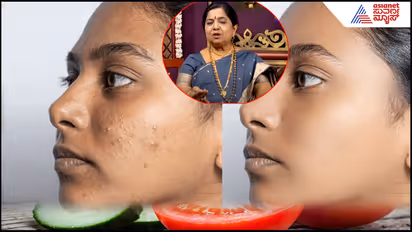 Ayurvedic tips for dark spots