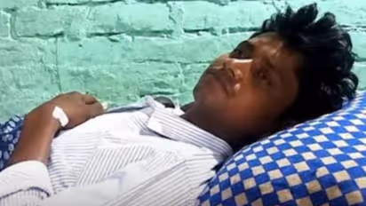 Kanpur man gets 55 stitches after sister-in-law bites