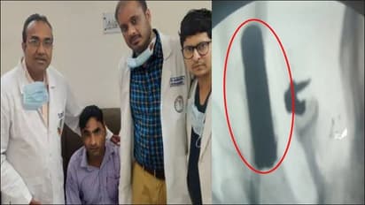 doctor remove bullet