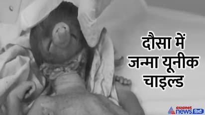 Ganpati like child born in dausa rajasthan