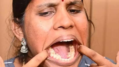 kalpana balan Teeth