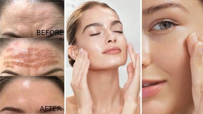 Skin Tightening Home Remedies