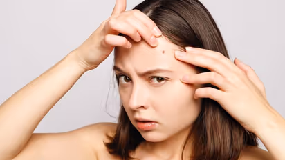 personality-traits-mole-on-forehead