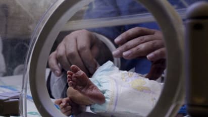 Children care, rules for changing nappy, caution in changing nappy, trending news, viral news, shocking news, health expert view