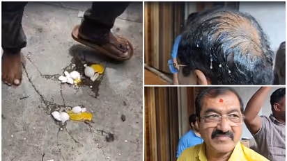 BJP MLA BP Harish egged