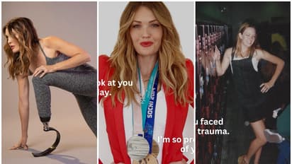 amy purdy