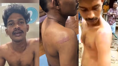 police custody torture