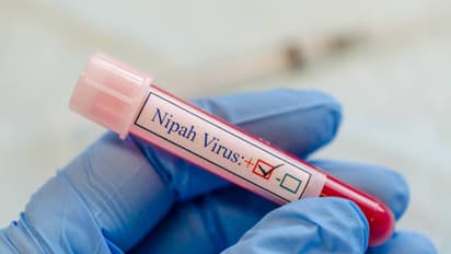 nipah virus spread  causes prevention