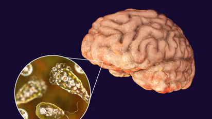 Brain Eating Amoeba