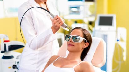 laser hair removal
