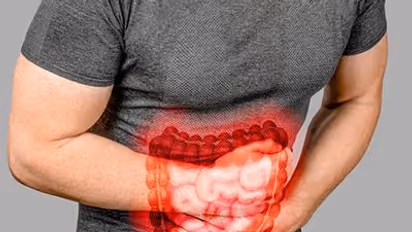 irritable bowel syndrome