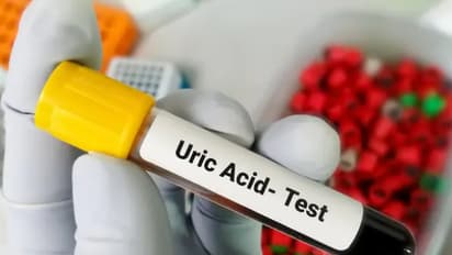 uric acid