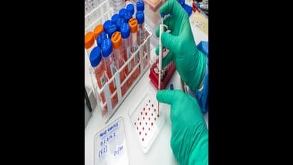 Air pollution may prevent Covid 19 vaccines from producing antibodies research claims 