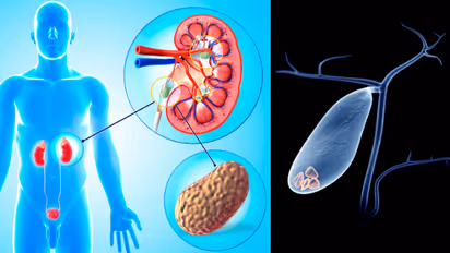 Kidney Vs Gallbladder Stone