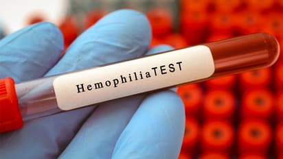 World Hemophilia Day 2023 