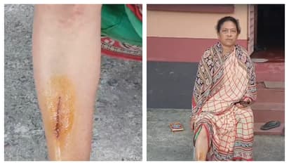 Miscreants attacked TMC MLA usha rani mondal from Meenakh bsm