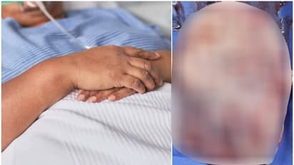 7 kilogram ovarian tumor