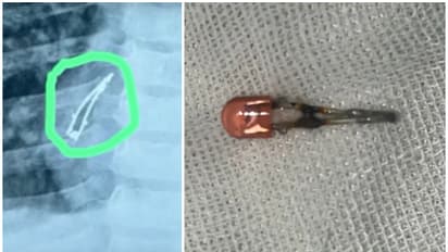 led bulb swalllow baby