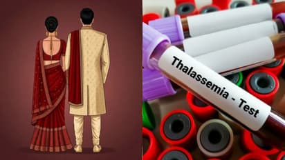 Maharashtra to make thalassemia test must before wedding 