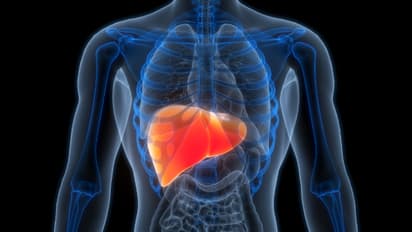 liver cancer
