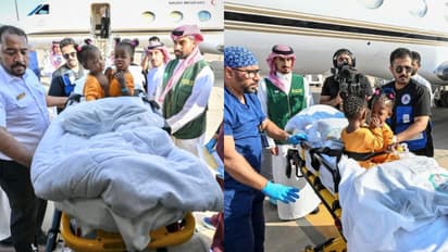 jamaican conjoined twins reached riyadh