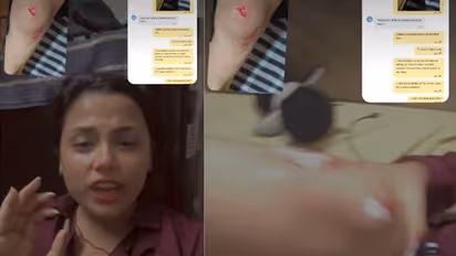Delhi Woman Jumps From Moving Rapido Bike After Driver Allegedly Refuses to Stop, Shares Terrifying Ordeal | WATCH