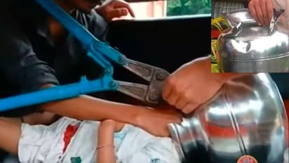 Boy's head stuck in bowl, firefighters come to the rescue