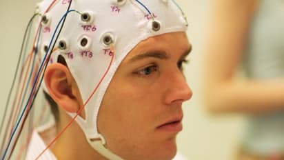 Covid-19 could cost some patients' brains to age 10 years