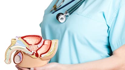 A UK man has 3 Penises