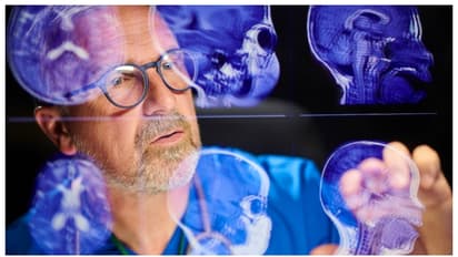 Brain health is crucial for longevity