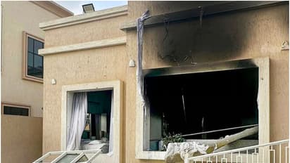 man suffers burns in villa fire 