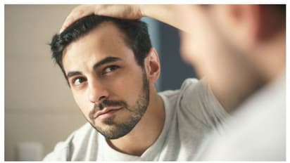hair loss to stop men