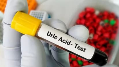 uric acid