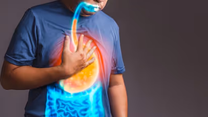 Heartburn