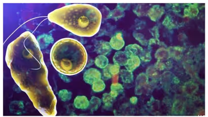 amoebic encephalitis