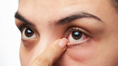 eye twitching kan imai thudippu