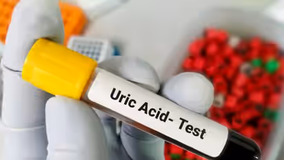 uric acid