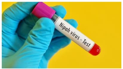 nipah virus