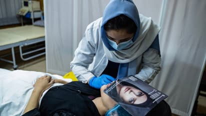 Cosmetic Surgery in Vogue in Afghanistan