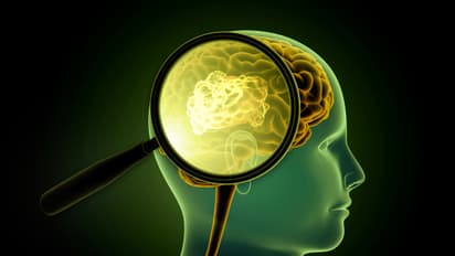 Glioblastoma Rewires Skull and Immune System in Deadly Way