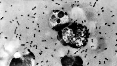bubonic plague
