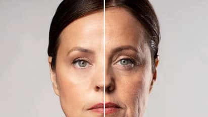 anti aging